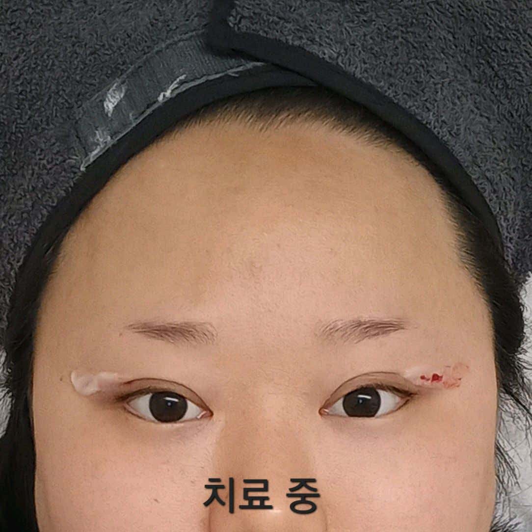 방문자가 첨부한 사진 2