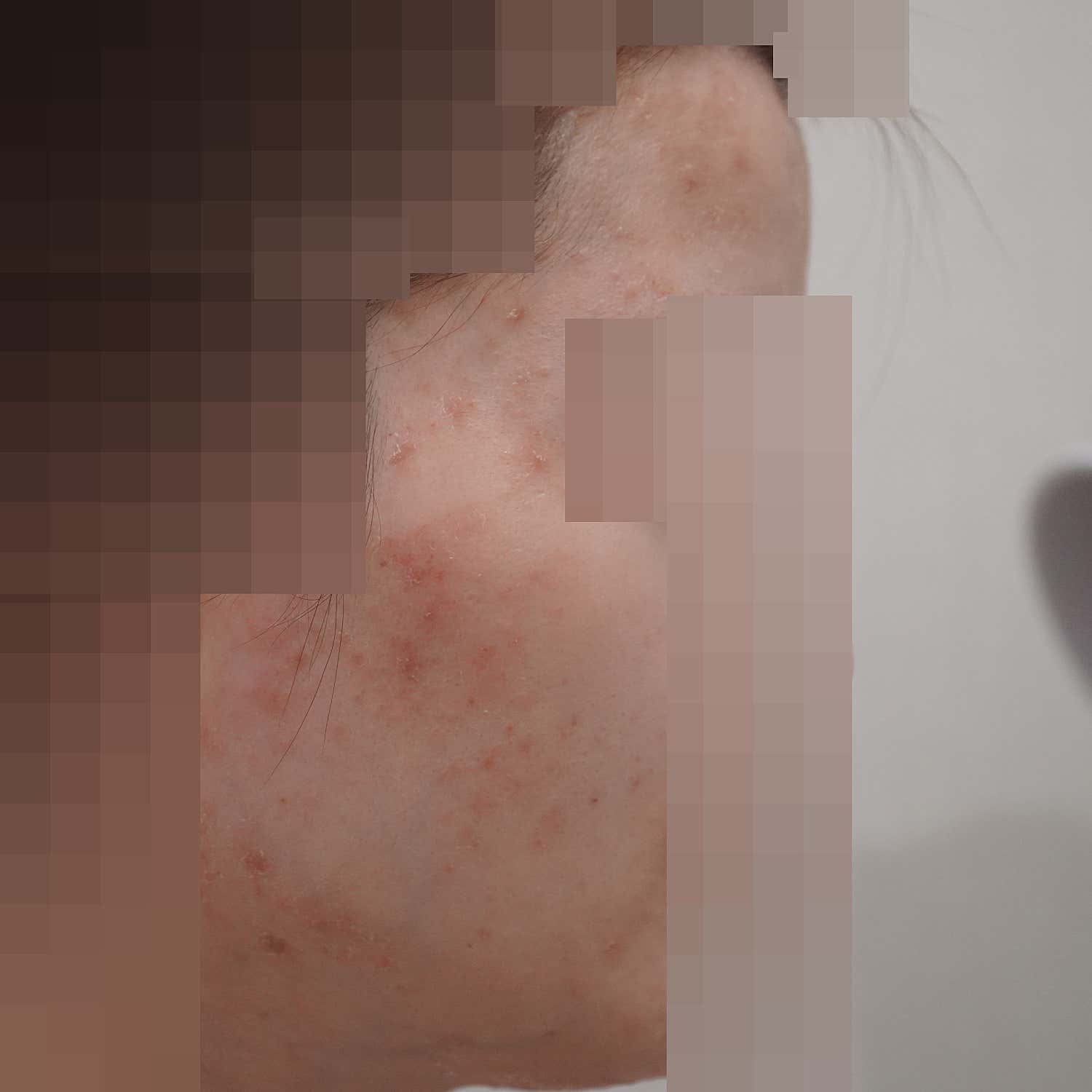방문자가 첨부한 사진 1
