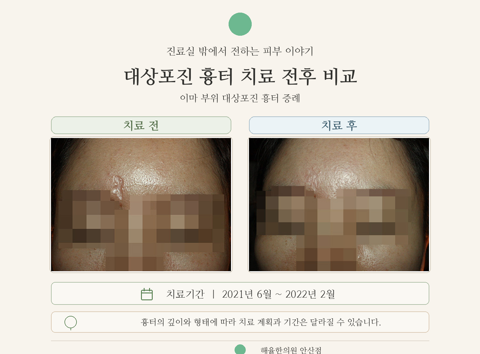 치료 전후 비교 사례 사진