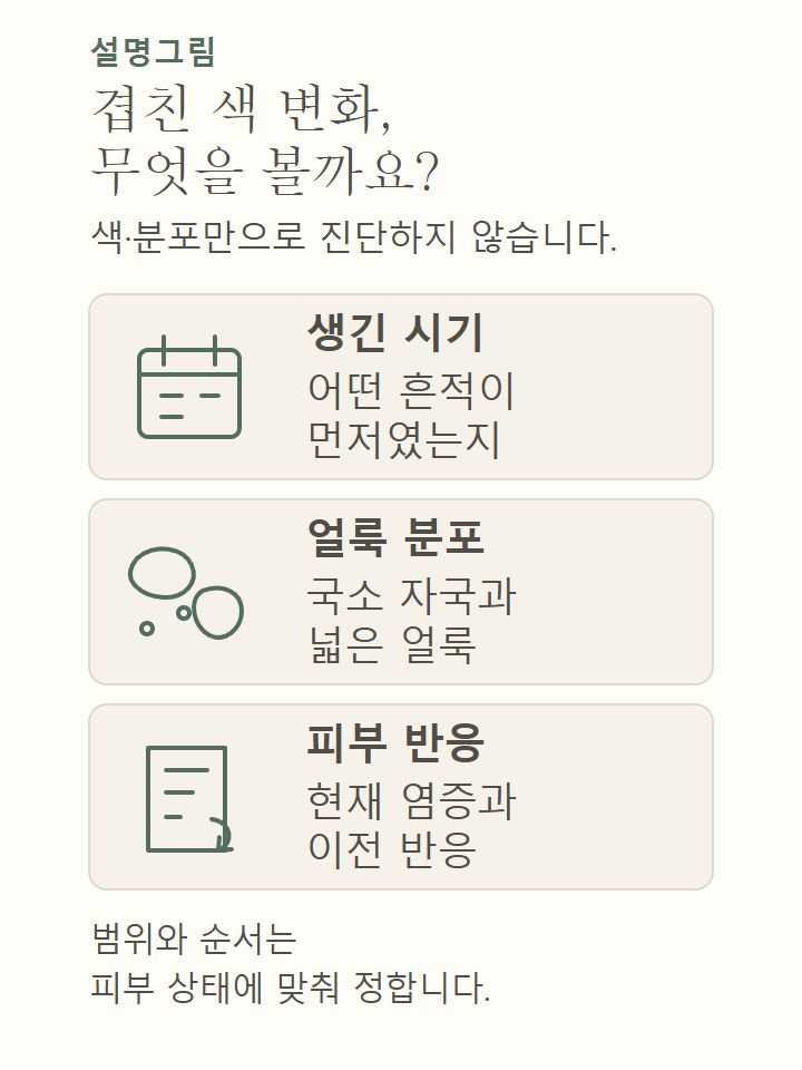 겹쳐 보이는 색 변화의 발생 시기와 얼룩 분포, 현재 염증과 이전 반응을 상담에서 확인하는 설명도식