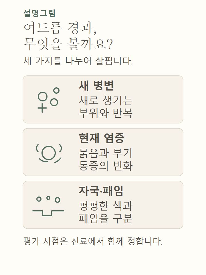여드름 치료 경과를 새 병변, 현재 염증과 통증, 남은 자국과 패임으로 나누어 살피는 설명도식