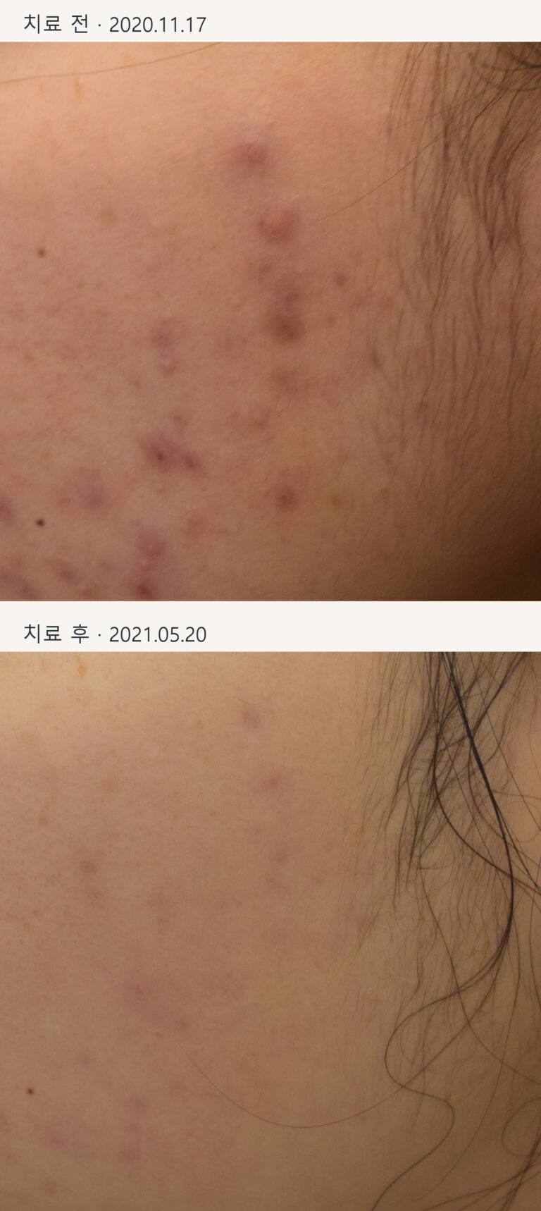 비포·애프터 사례 사진