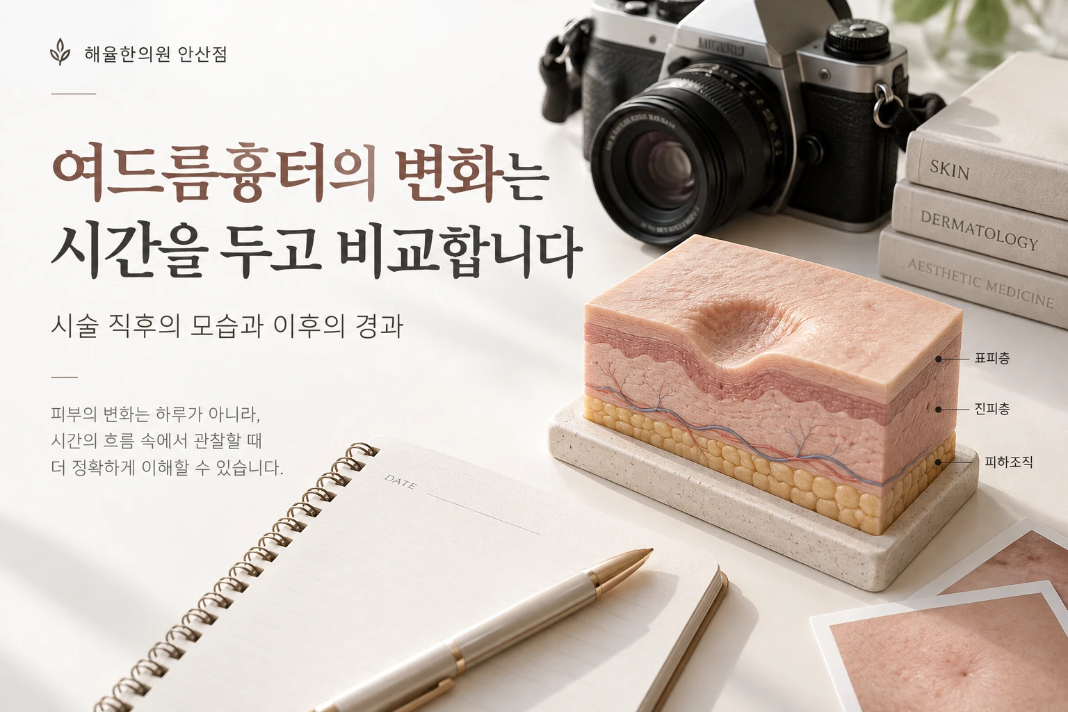 여드름흉터 치료 후 변화를 기록하고 비교하는 상담 안내