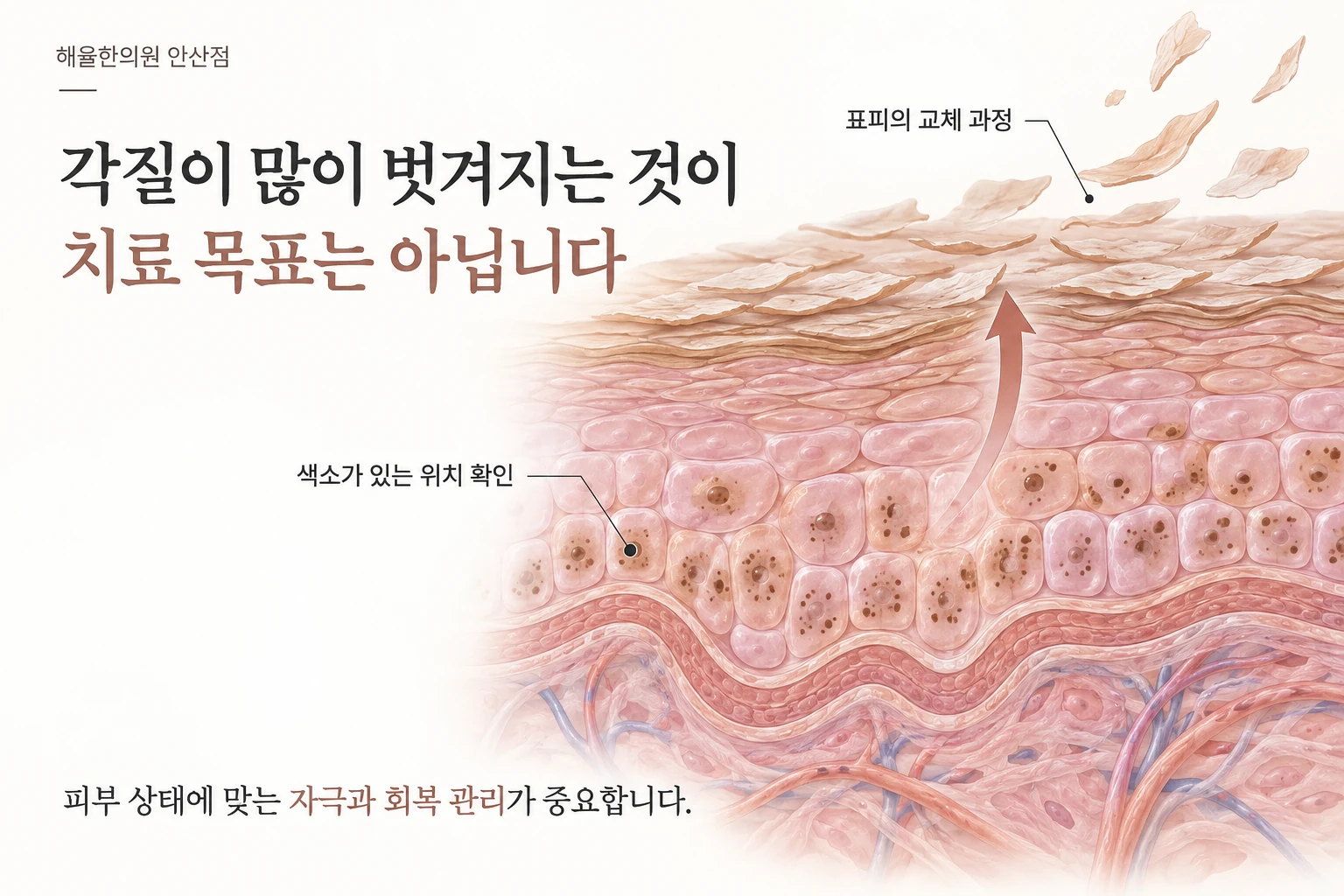 색소를 담은 표피세포가 교체되는 과정