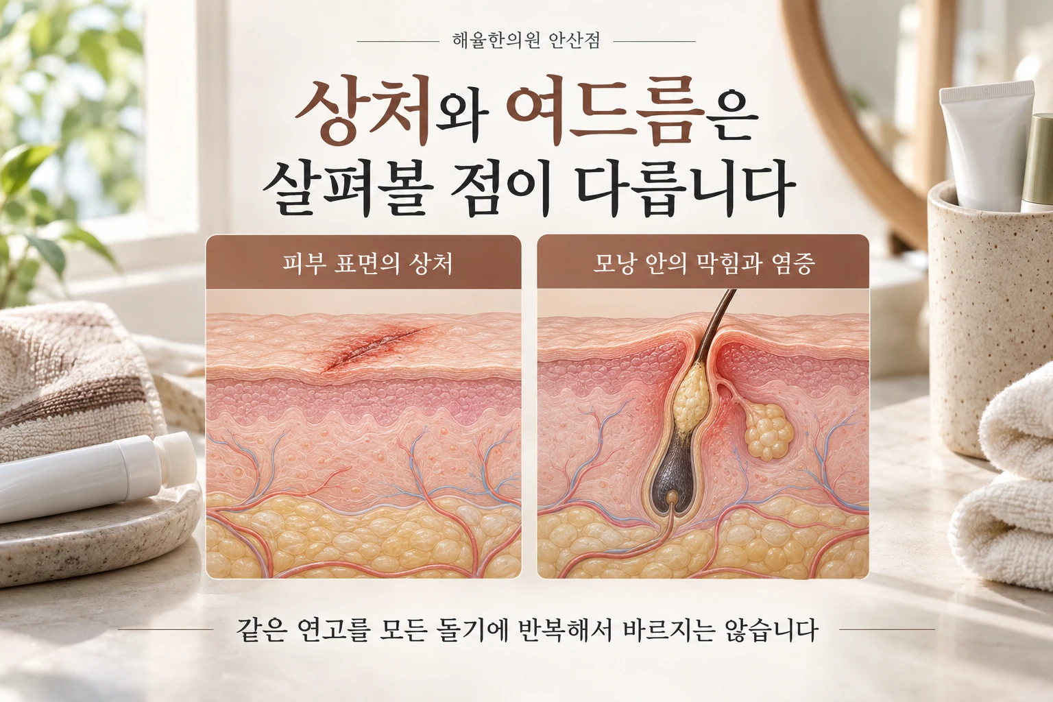 현재 상처 관리와 여드름 치료의 목적 구분