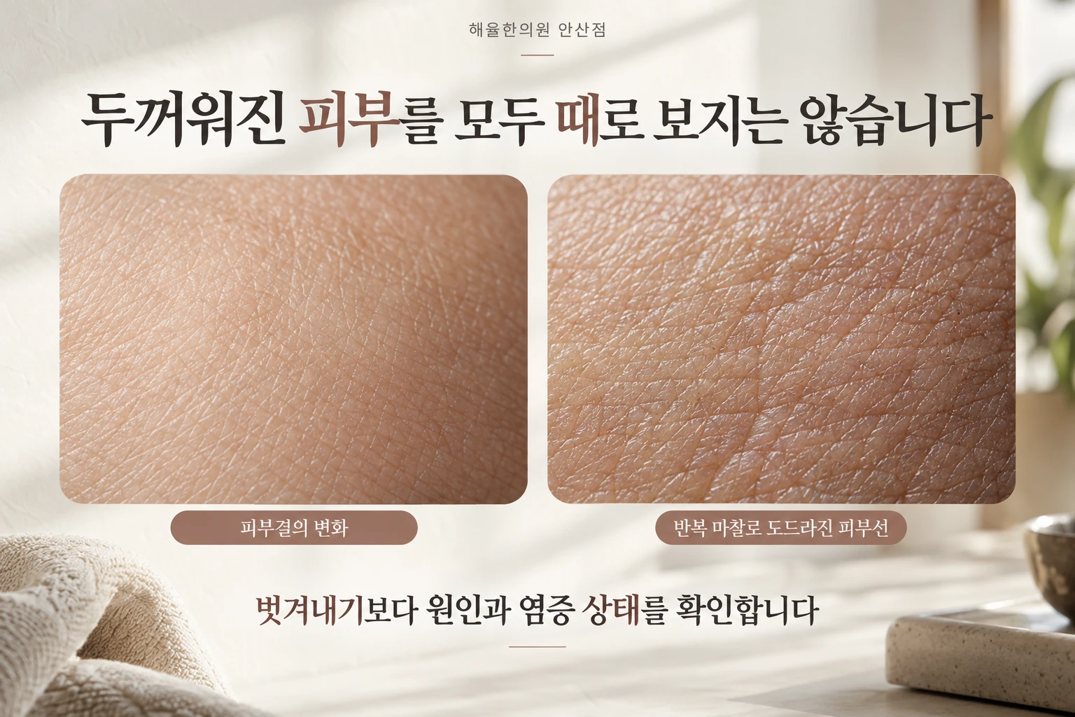 태선화된 피부와 표면 각질을 구분하는 설명