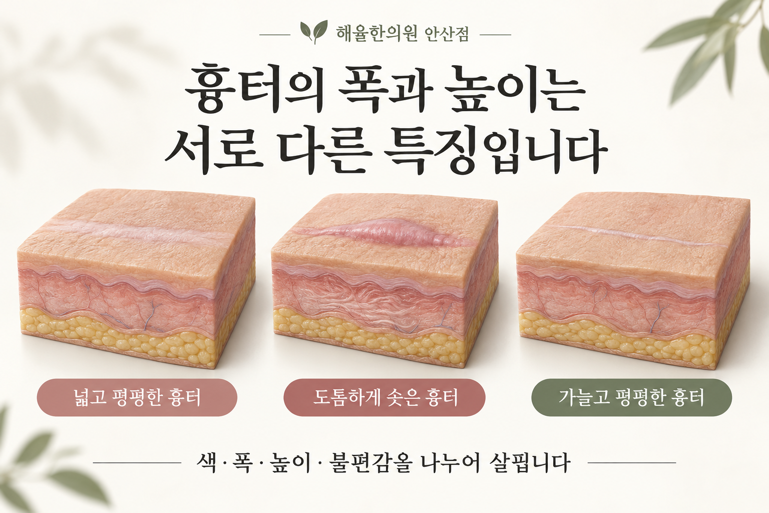 흉터의 폭과 높이 및 표면 형태의 구분