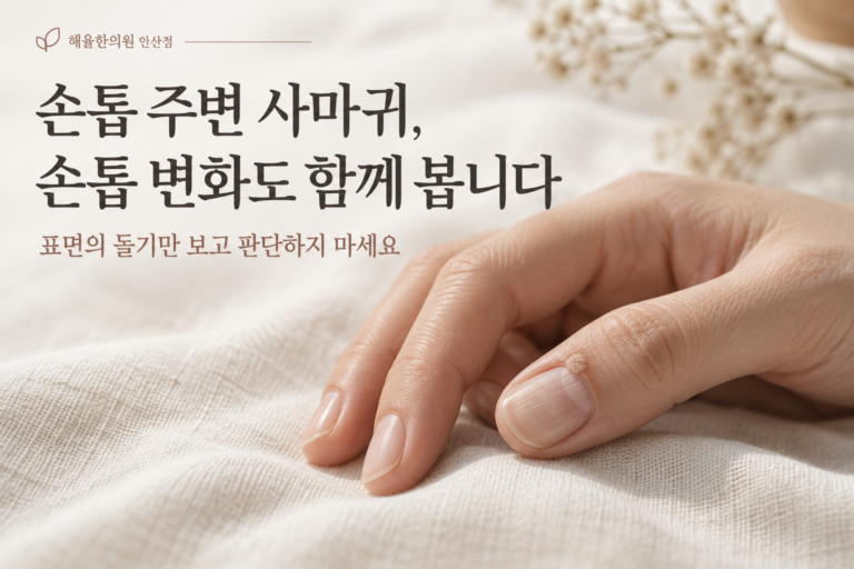 손발톱주위 사마귀와 손톱 변화 칼럼 썸네일