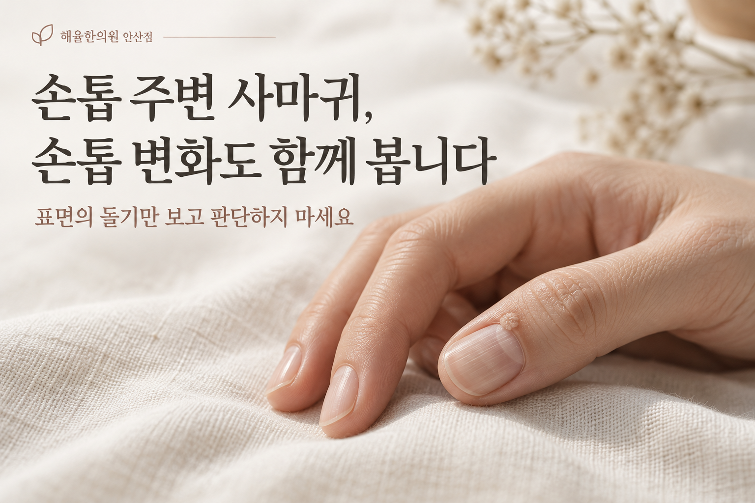 손발톱주위 사마귀와 손톱 변화 칼럼 썸네일