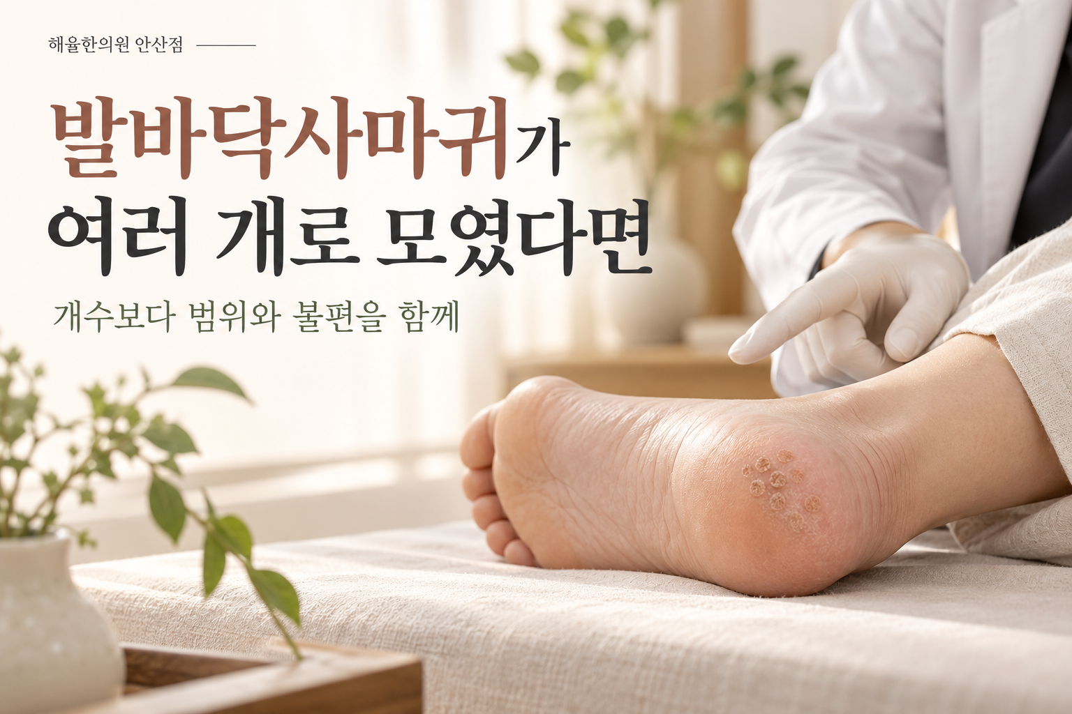 모여 넓어지는 발바닥사마귀 칼럼 썸네일