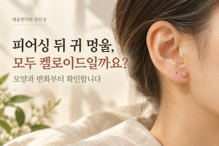 피어싱 뒤 귀 멍울 칼럼 썸네일