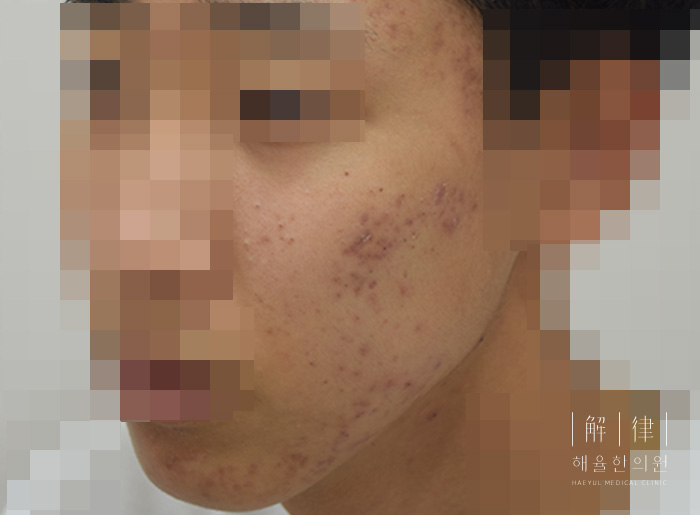 사례 사진 비포