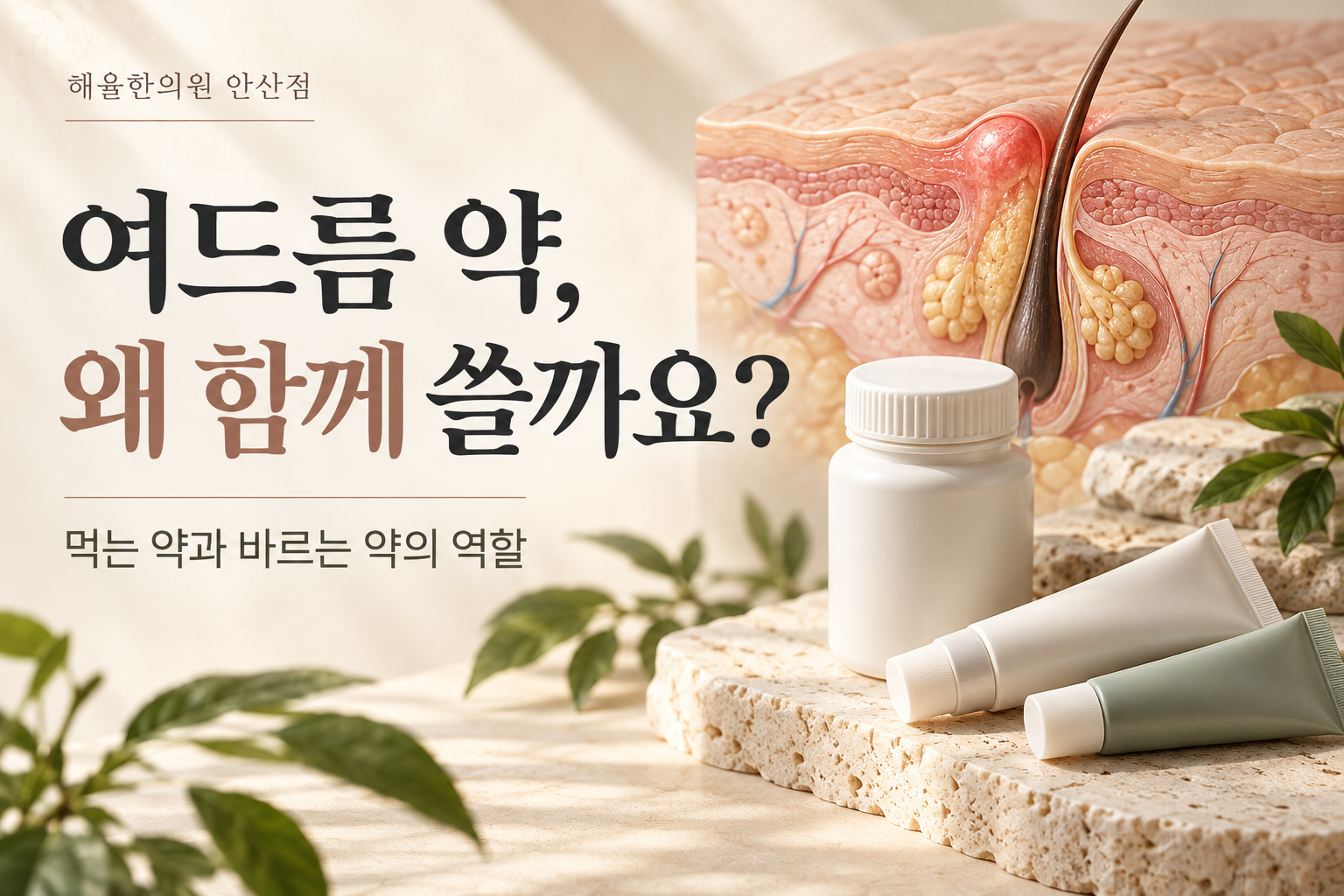 여드름 병용치료 칼럼 썸네일